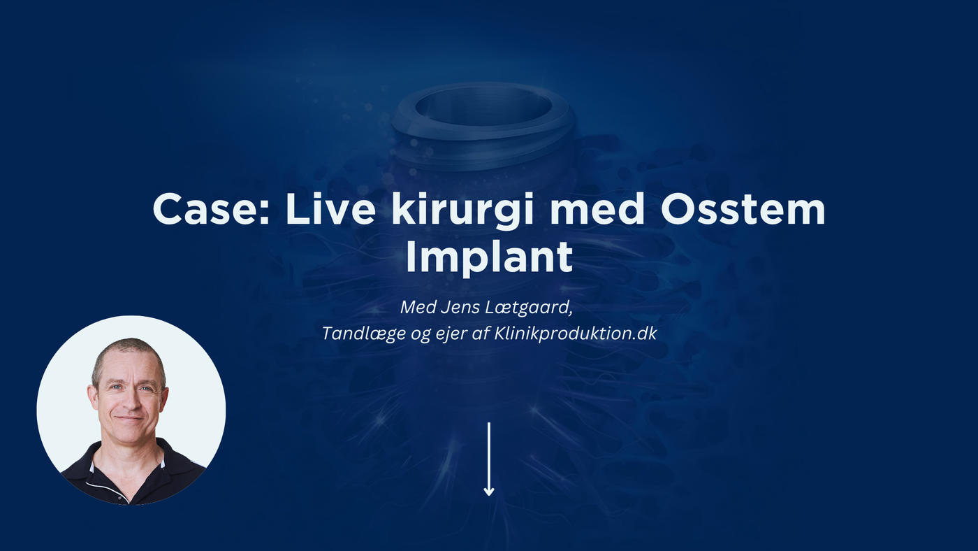 Case: Da vi gik live med tandlæge Jens Lætgaard