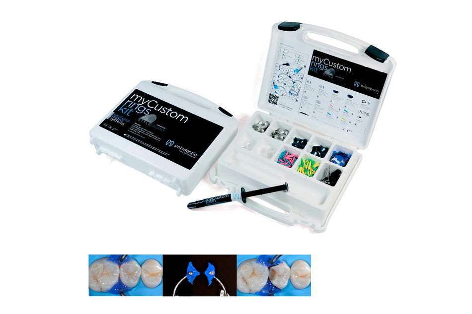 myCustom Rings kit