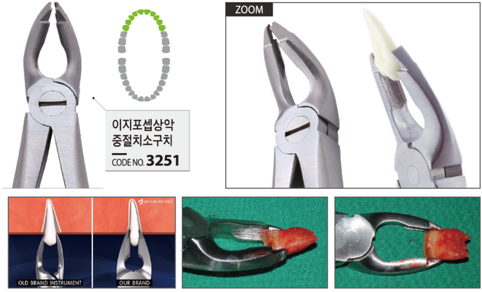 Easy forceps ekstraktionstang