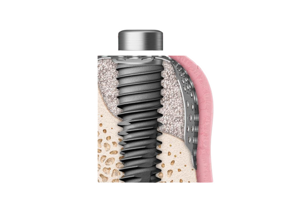 OssBuilder komponent, healing Cap