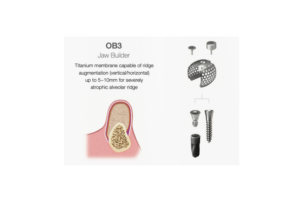 OssBuilder OB3, Jaw Builder horisontal 10 mm