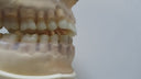 Akro-Flex Must-Have-Kompositinstrument